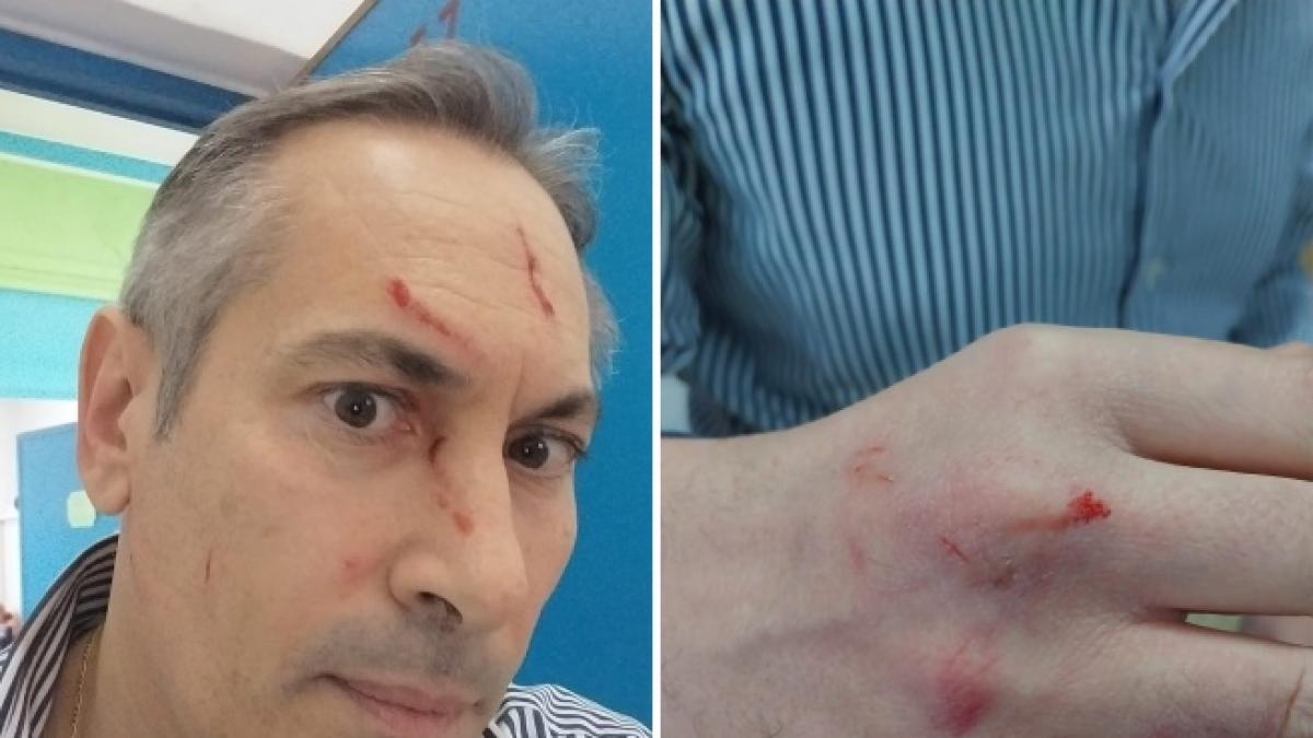 Genitori violenti, lettera di un docente: picchiateci tutti, se temete che renderemo i vostri figli migliori di voi -