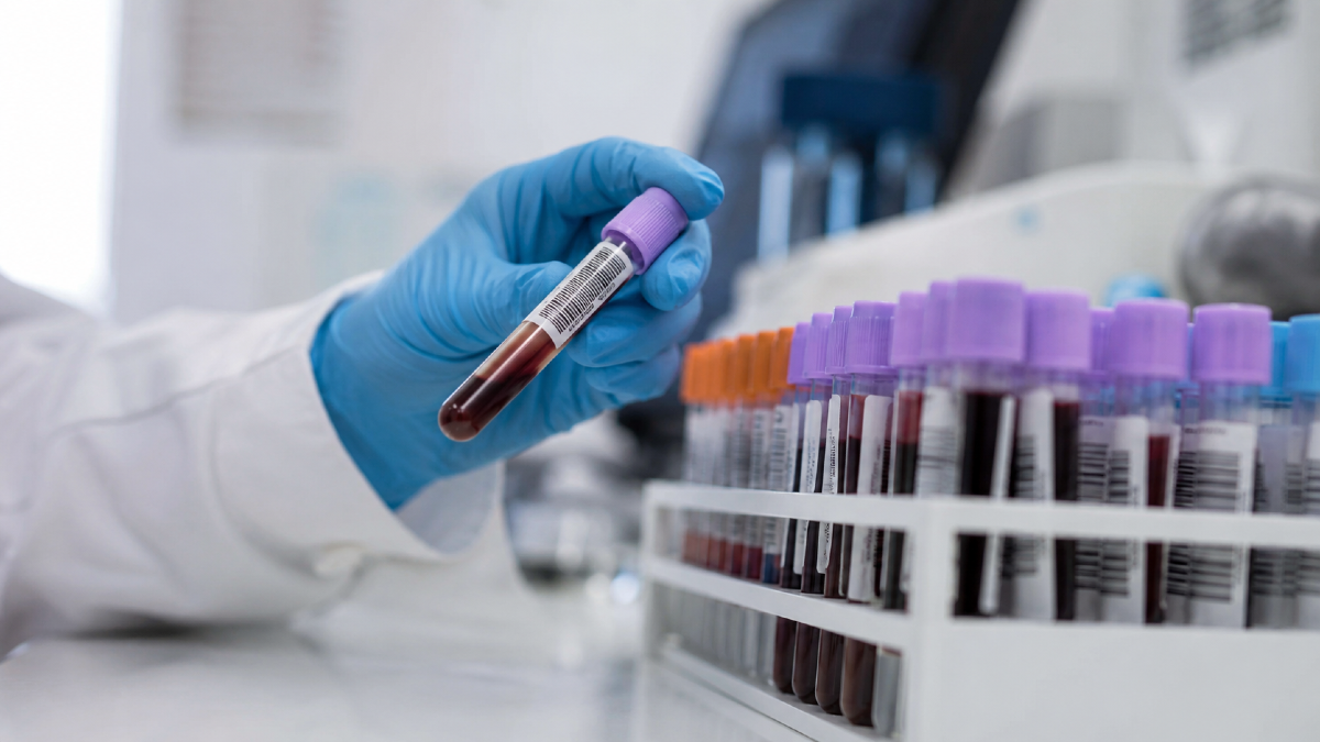 Autismo, un test del sangue per anticipare la diagnosi? - 